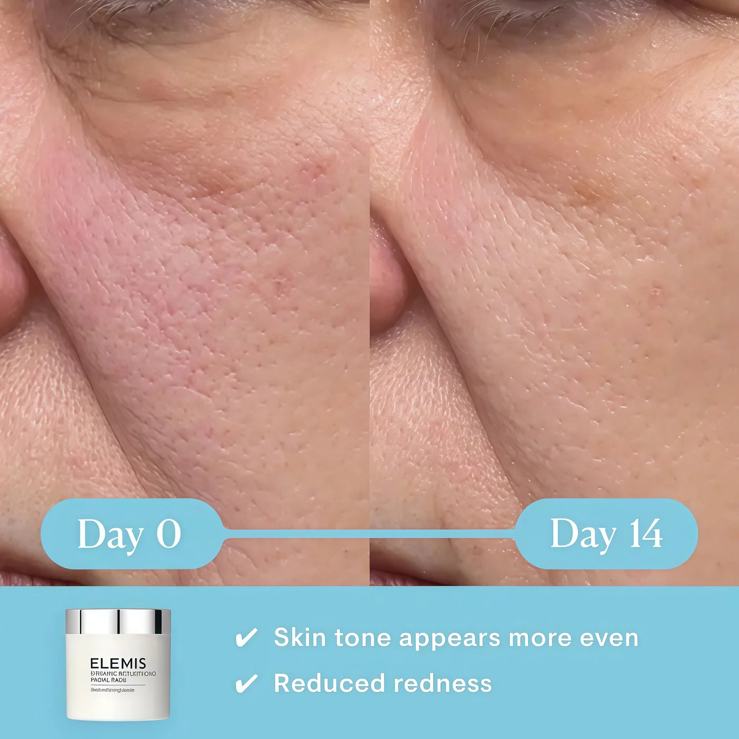 ELEMIS Dynamic Resurfacing Facial Pads, Gentle Textured Treatment Facial Exfoliating Pads