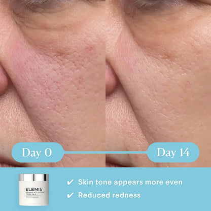 ELEMIS Dynamic Resurfacing Facial Pads, Gentle Textured Treatment Facial Exfoliating Pads